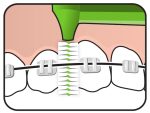 TePe Interdental Brush Angle Μεσοδόντια Οδοντόβουρτσα Πράσινο 0.8mm Μέγεθος 5, 6 τεμάχια - Image 2