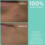 Apivita Just Be Clear Gel Καθαρισμού - Εξυγιαίνει το Δέρμα με Propolis AmC & Φυτικό Σαλικυλικό Οξύ, 200ml - Image 3