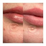 Hero. Mighty Patch Duo Anti-Pimple Επιθέματα για Σπυράκια, 12 τεμάχια - Image 3