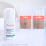 Avène Cleanance Comedomed+ μ Κρέμα-Gel κατά των Ατελειών με Comedoclastin™ για Δέρμα με Τάση Ακμής, 30ml - Image 5